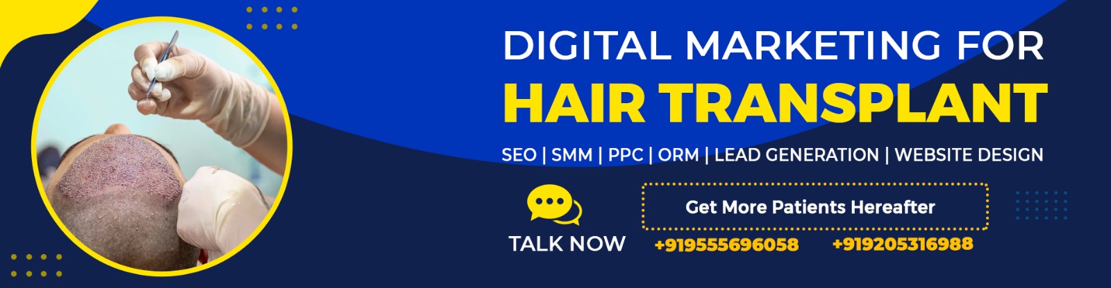 hair transplant seo smo ppc digital marketing